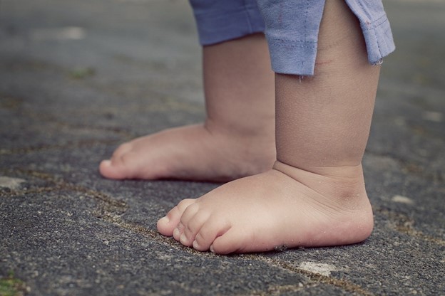 what-causes-flat-feet
